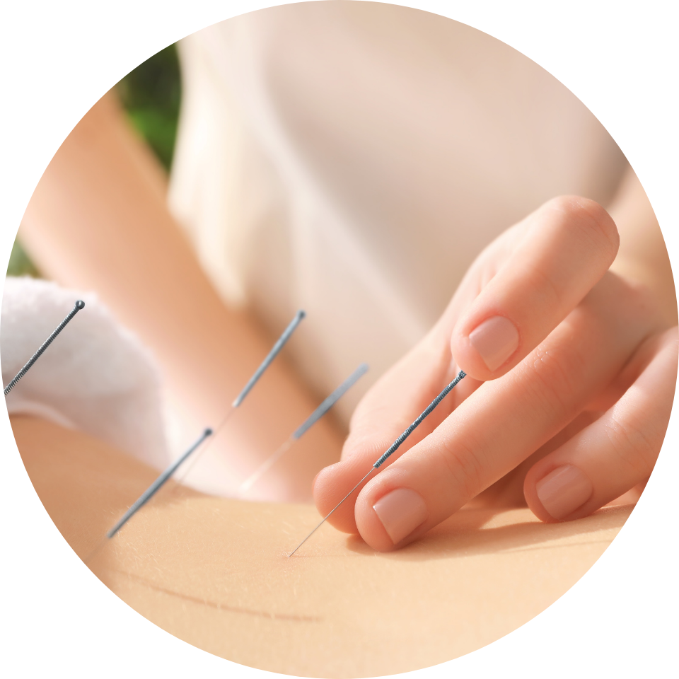 acupuntura santa felicidade