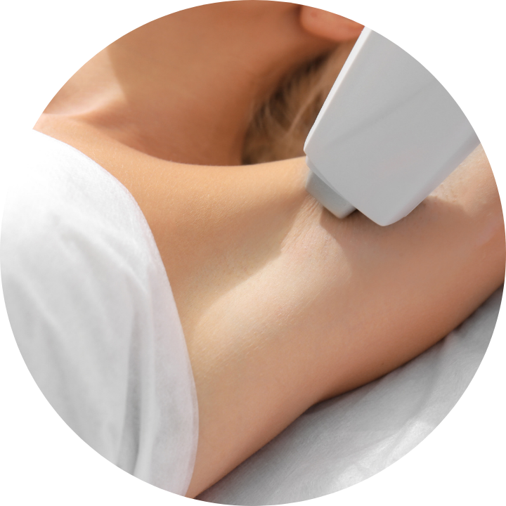 depilação-a-laser